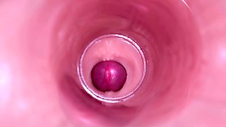 Female Insemination - Internal Camera Captures Deep Male Ejaculation