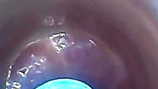 Endoscope POV: Test Tube Cock Urethral Insertion