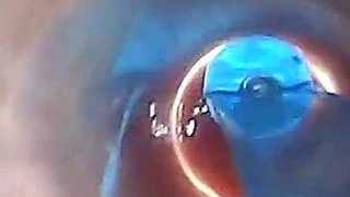 Endoscope POV: Test Tube Cock Urethral Insertion