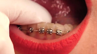 Pussy masturbation, braces fetish, medical gloves - MILF Arya Grander solo masturbation