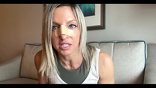 Boxer Lora Cross Breaks Nose and Gets a Nose Cast